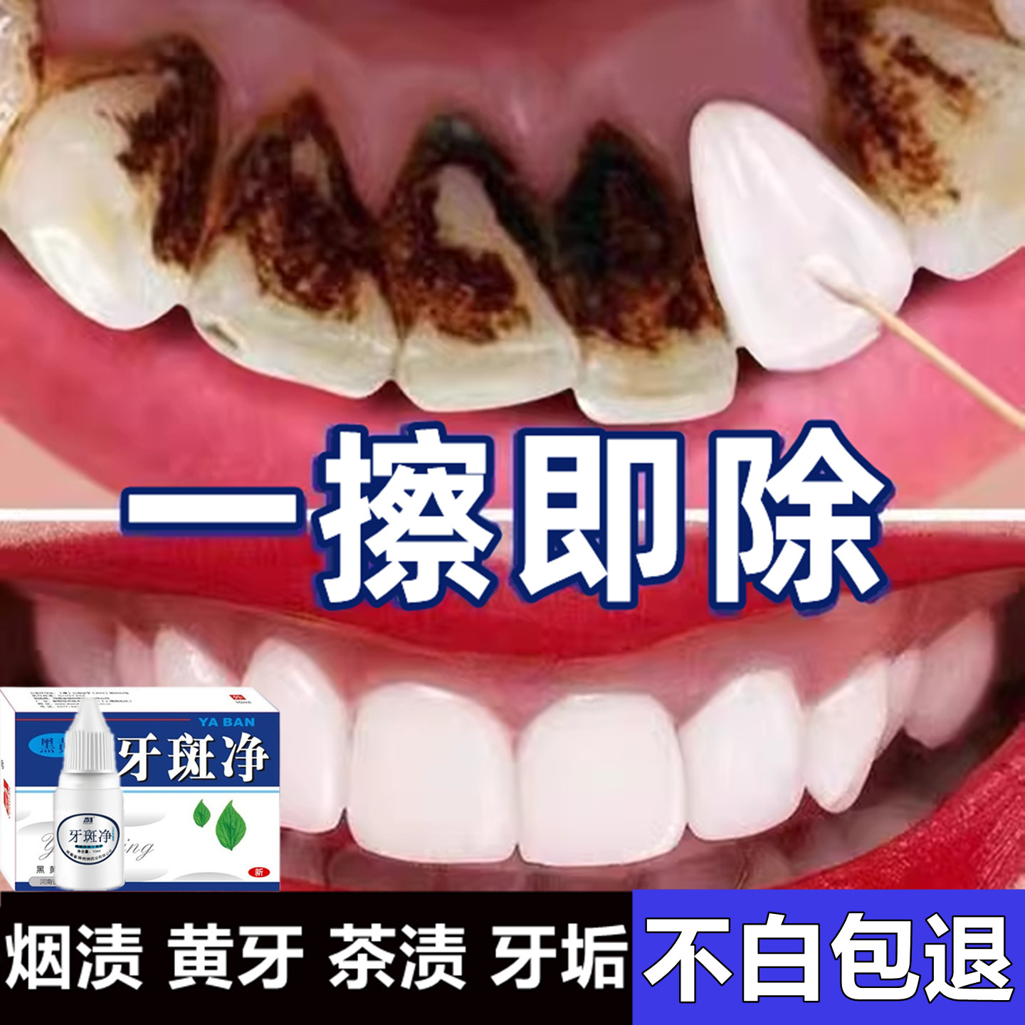 牙膏去黄去口臭美白成人强力去除烟渍牙垢牙结石溶解男士专用神器