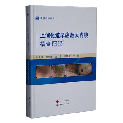 上消化道早癌放大内镜精查图谱刘志国 勇 王雷 李晓波 著世界图书出版公司内科学