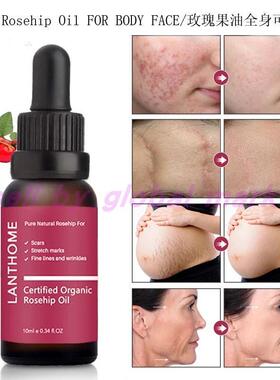 Rosehip Oil Organic Scars Stretch Marks玫瑰果油精华液脸身体