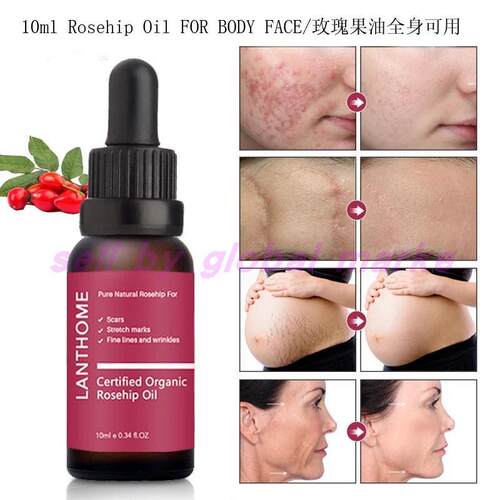 Rosehip Oil Organic Scars Stretch Marks玫瑰果油精华液脸身体