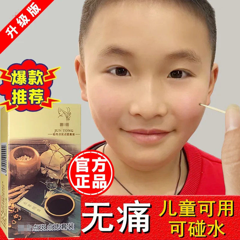 去痣点痣专用药水脸部点斑黑点痦子祛痣美容院点痣膏正品神器仪