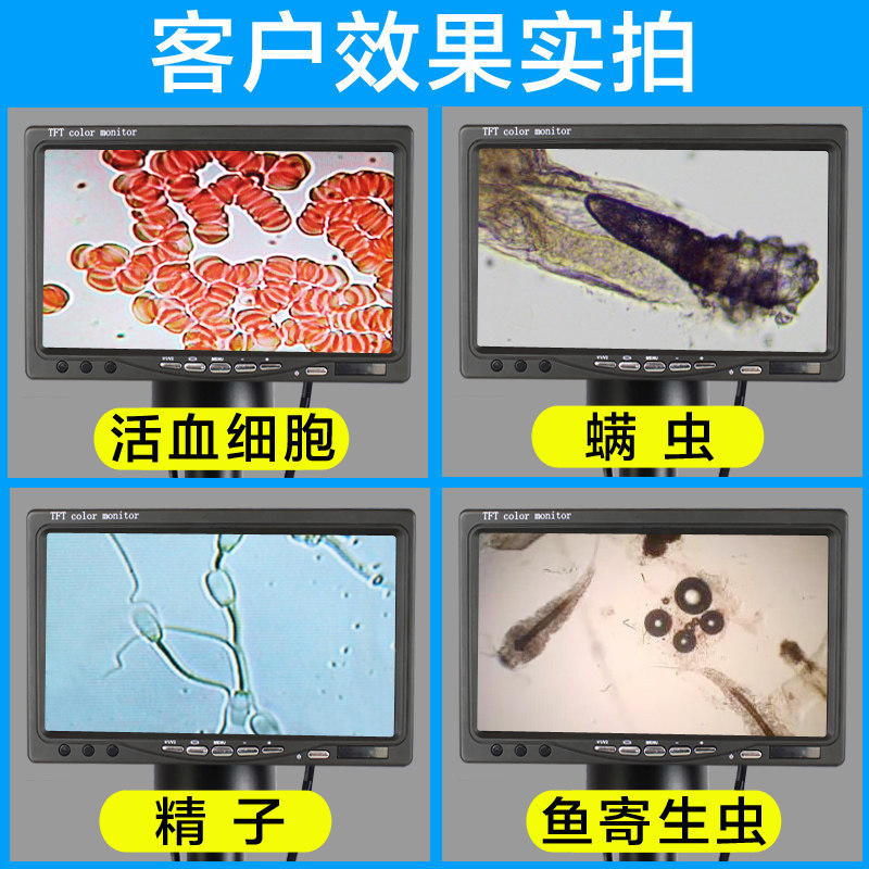 一滴血检测仪高清专业看血液血细胞检测血脂螨虫显微镜恒温载物台