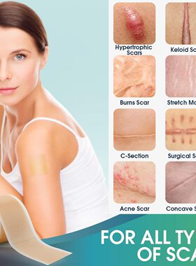 中性硅凝胶疤痕贴增厚自粘术后护理无痛皮肤贴疤痕贴纸硅胶贴修复