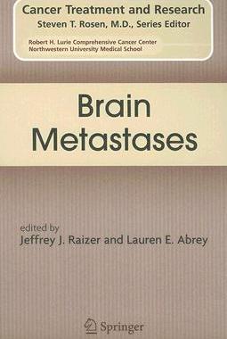 【预售】Brain Metastases