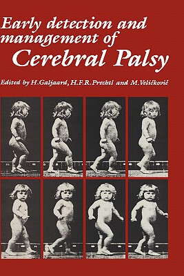 【预售】Early Detection and Management of Cerebral Palsy