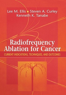 【预售】Radiofrequency Ablation for Cancer: Current