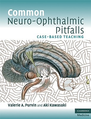 【预售】Common Neuro-Ophthalmic Pitfalls: Case-Based