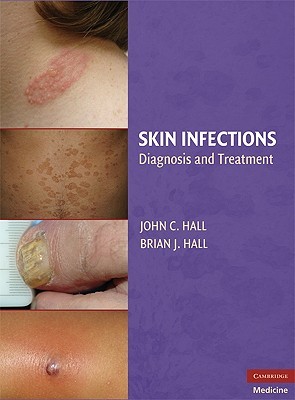 【预售】Skin Infections: Diagnosis and Treatment
