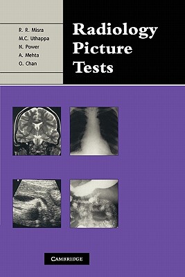 【预售】Radiology Picture Tests: Film Viewing and