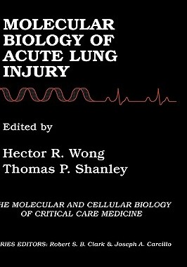 【预售】Molecular Biology of Acute Lung Injury
