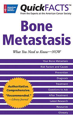 【预订】QuickFacts Bone Metastases: What You Need to Now --