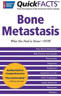 【预订】QuickFacts Bone Metastases: What You Need to Now --