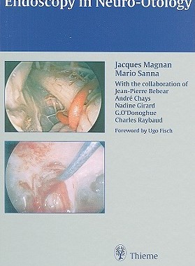【预订】Endoscopy in Neuro-Otology