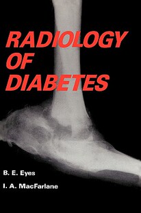 【预售】Radiology of Diabetes
