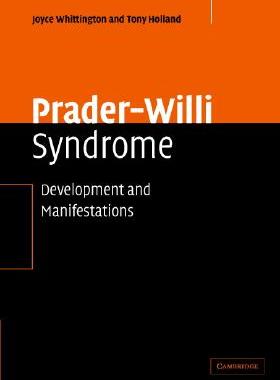 【预售】Prader-Willi Syndrome: Development and