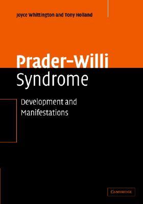 【预售】Prader-Willi Syndrome: Development and