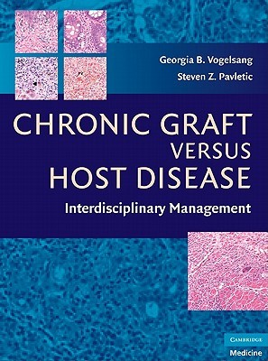【预售】Chronic Graft Versus Host Disease: Interdisciplinary