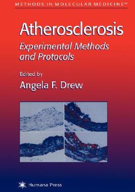 【预售】Atherosclerosis: Experimental Methods and Protocols