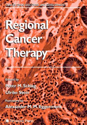 【预售】Regional Cancer Therapy