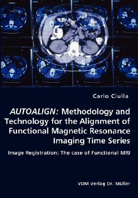 【预售】Autoalign: Methodology and Technology for the