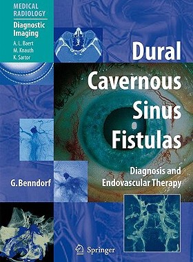 【预售】Dural Cavernous Sinus Fistulas: Diagnosis and