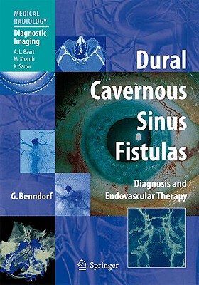 【预售】Dural Cavernous Sinus Fistulas: Diagnosis and