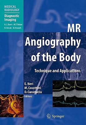 【预售】MR Angiography of the Body: Technique and Clinical