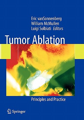 【预售】Tumor Ablation: Principles and Practice