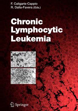 【预售】Chronic Lymphocytic Leukemia