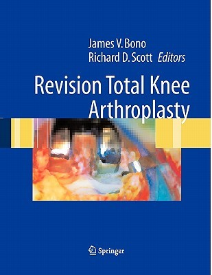 【预售】Revision Total Knee Arthroplasty
