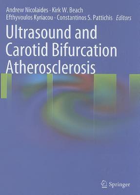 【预售】Ultrasound and Carotid Bifurcation Atherosclerosis