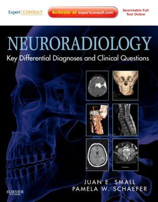 【预售】Neuroradiology: Key Differential Diagnoses and
