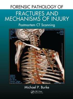 【预售】Forensic Pathology of Fractures and Mechanisms of