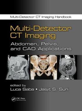 【预售】Multi-Detector CT Imaging: Abdomen, Pelvis, and CAD