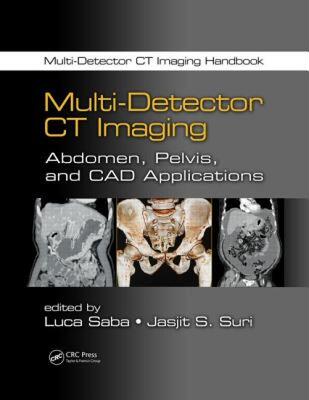【预售】Multi-Detector CT Imaging: Abdomen, Pelvis, and CAD