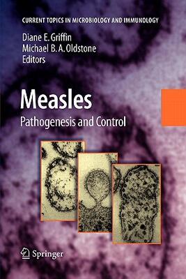 【预售】Measles: History and Basic Biology