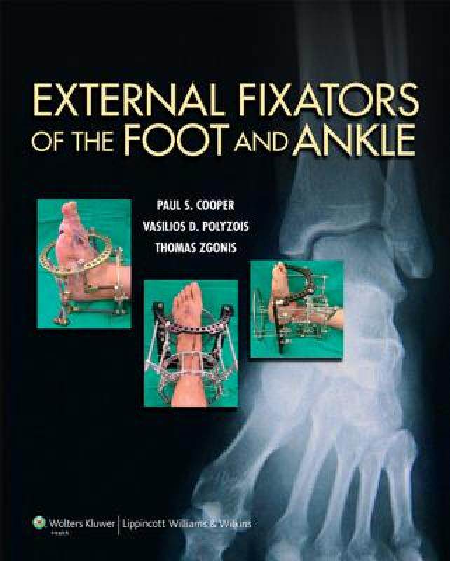 【预售】External Fixators of the Foot and Ankle
