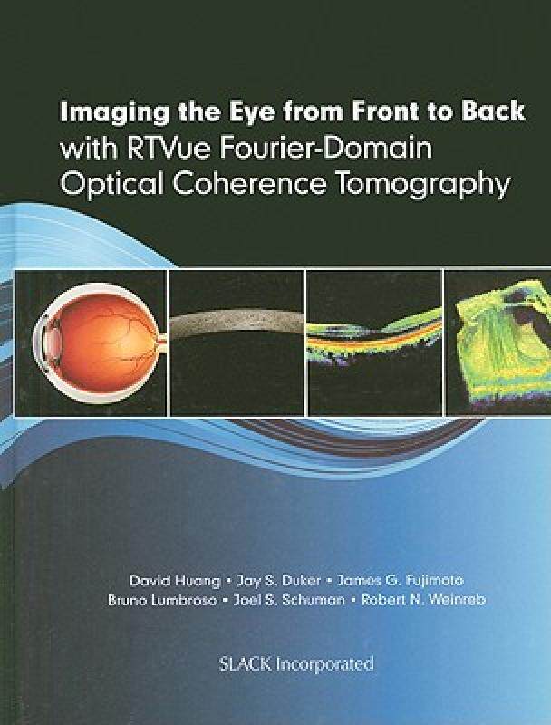 【预售】Imaging the Eye from Front to Back with RTVue