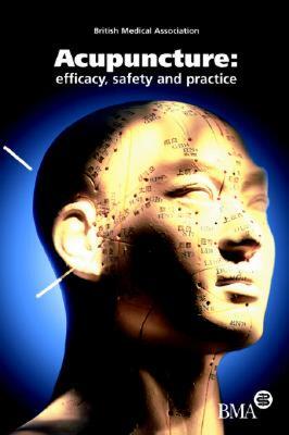 【预售】Acupuncture: Efficacy, Safety and Practice