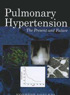 【预售】Pulmonary Hypertension