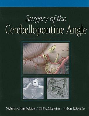 【预售】Surgery of the Cerebellopontine Angle [With DVD]