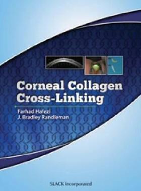 【预售】Corneal Collagen Cross Linking