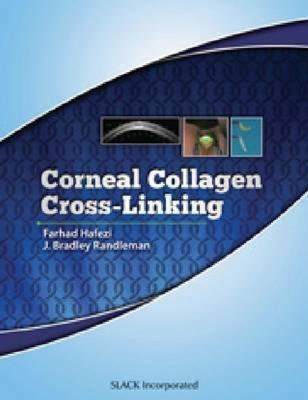 【预售】Corneal Collagen Cross Linking