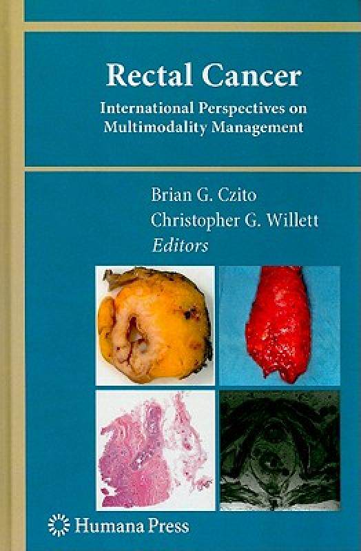 【预售】Rectal Cancer: International Perspectives on