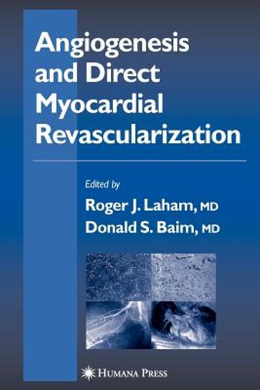 【预售】Angiogenesis and Direct Myocardial