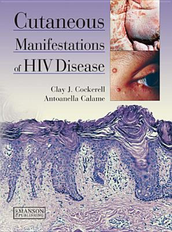 【预售】Cutaneous Manifestations of HIV Disease