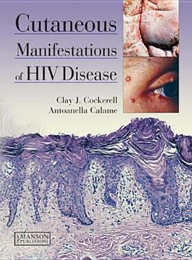 【预售】Cutaneous Manifestations of HIV Disease