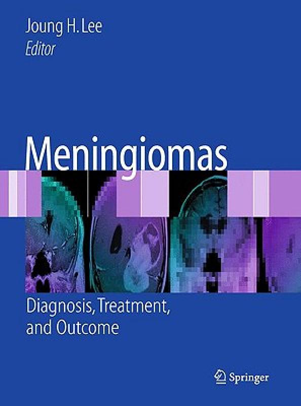 【预售】Meningiomas: Diagnosis, Treatment, and Outcome