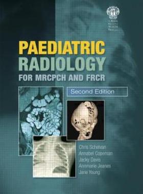 【预售】Paediatric Radiology for Mrcpch and Frcr