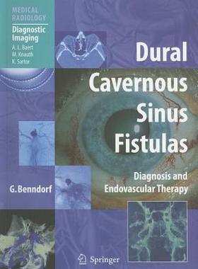 【预售】Dural Cavernous Sinus Fistulas: Diagnosis and